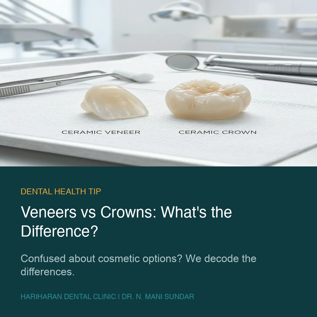 Veneers vs crowns — the difference